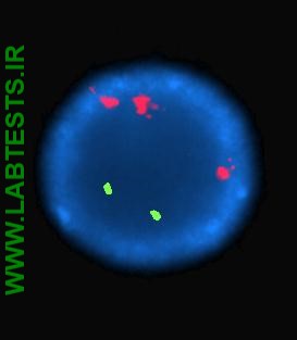A cell that is positive for trisomy