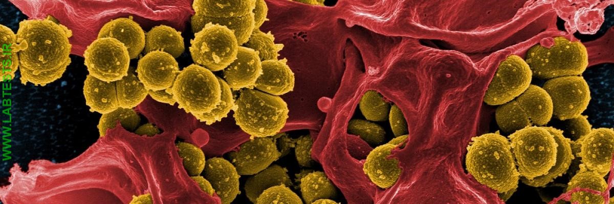 MRSA