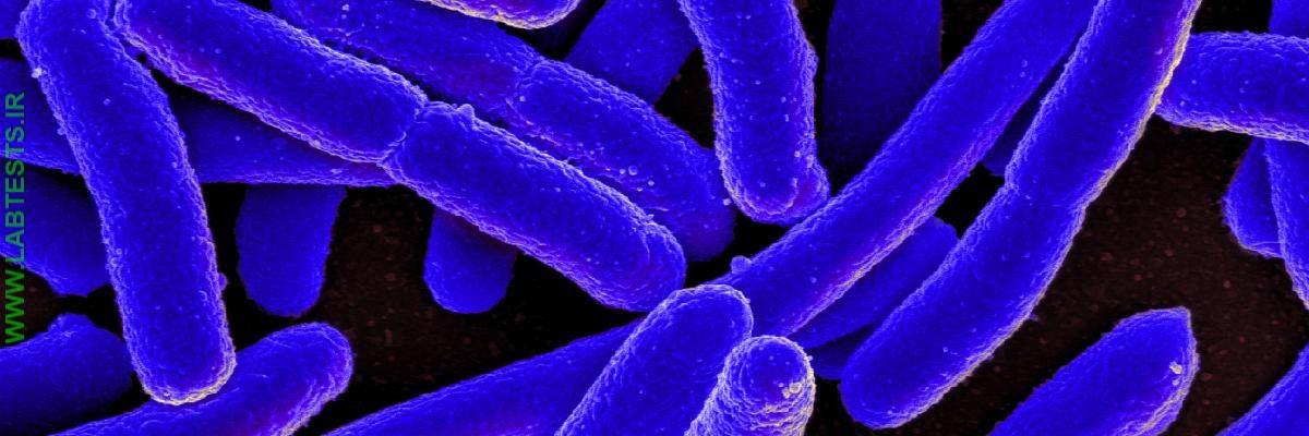 E. coli