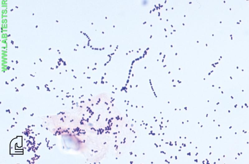 Image of Gram positive cocci