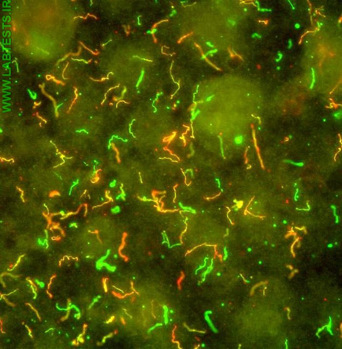 Photo of Borrelia burgdorferi bacteria that cause Lyme Disease.