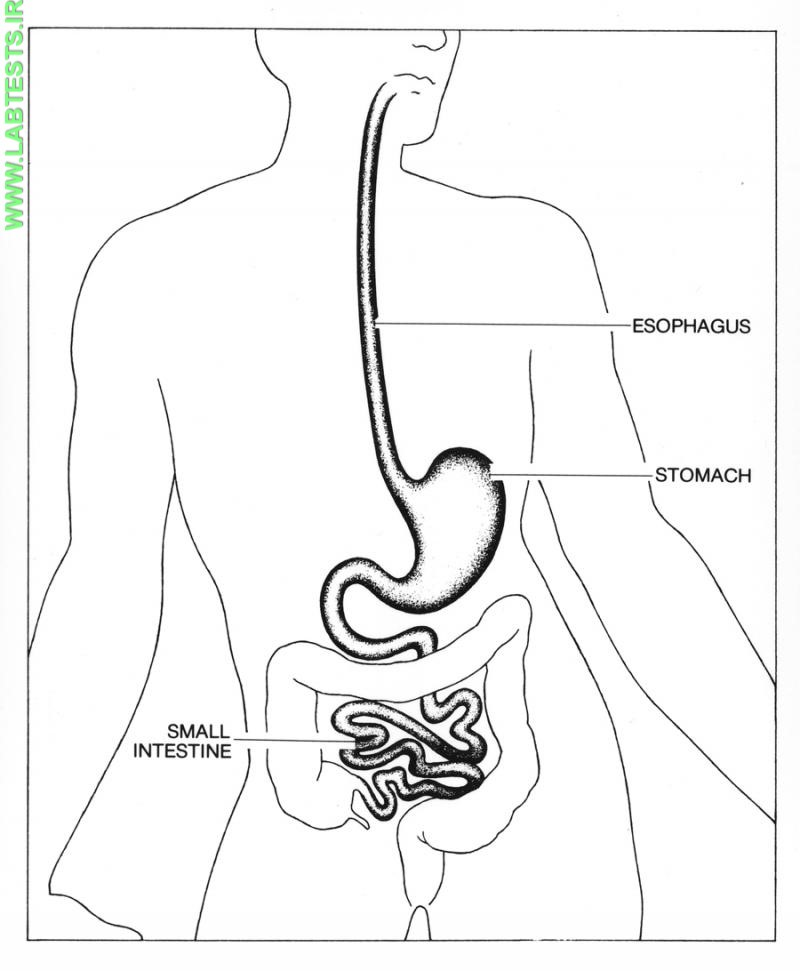 Drawing of stomach and esophagus