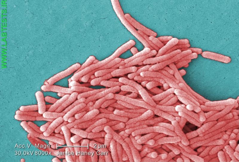 Photo of Legionella bacteria