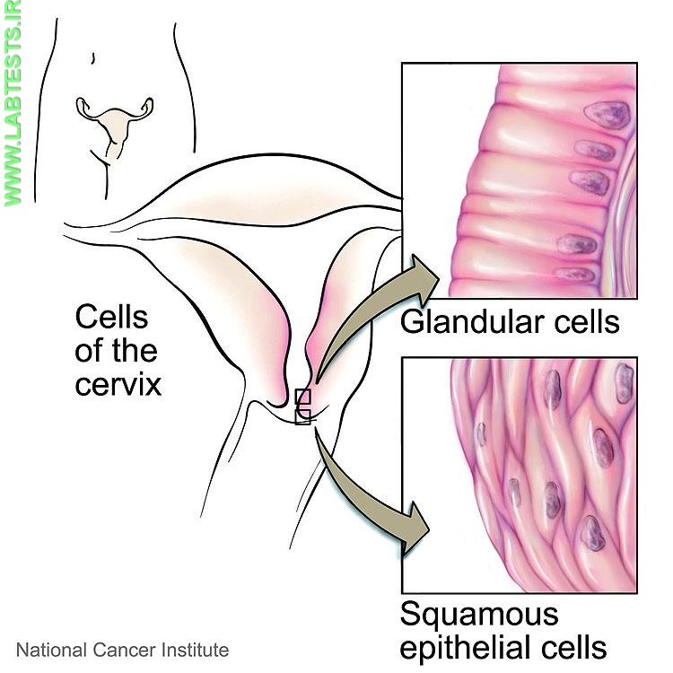 Drawing of cervical cells