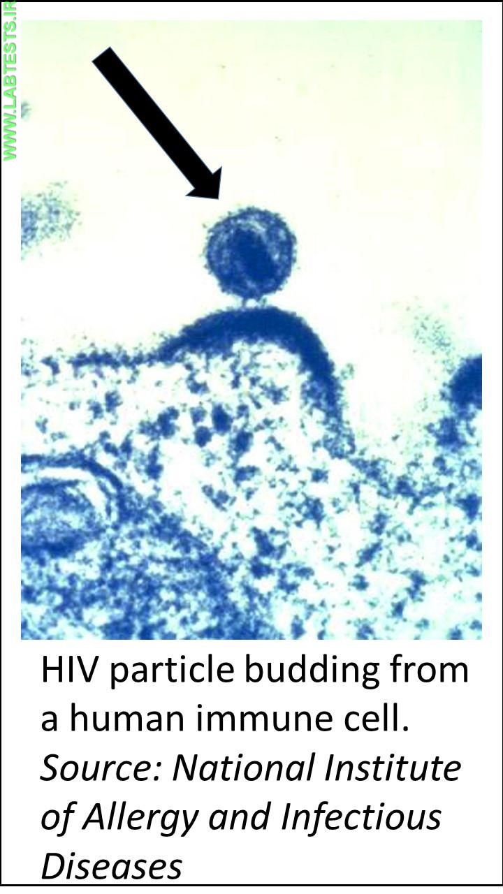 Photo of HIV particle