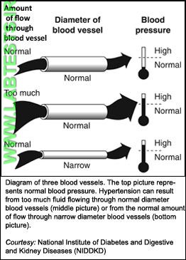 Diagram of hypertension