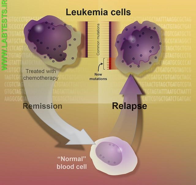 Leukemia Cells