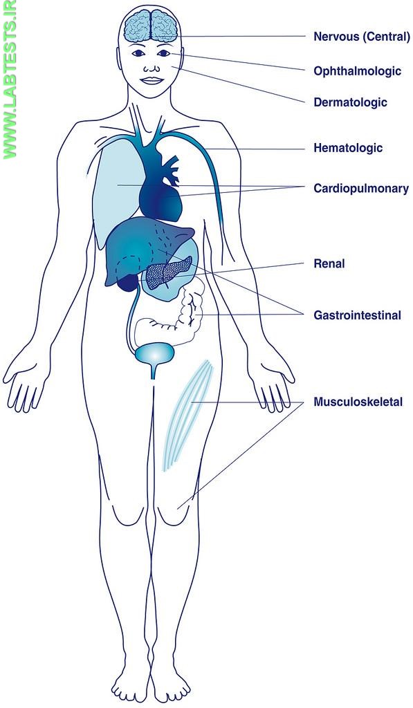 Areas affected by lupus