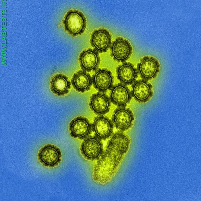 Image of flu virus particles