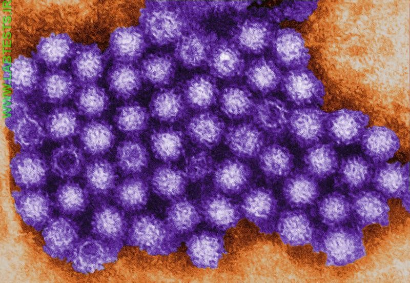 Norovirus particles
