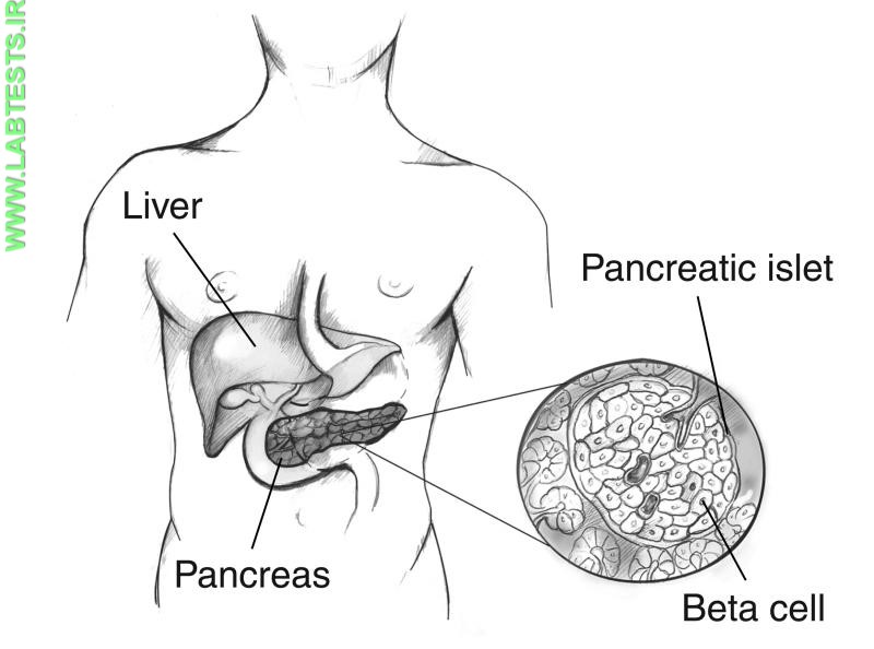 Drawing of pancreas with close up of beta cells