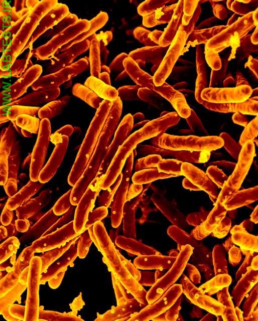 Photo of Mycobacterium tuberculosis