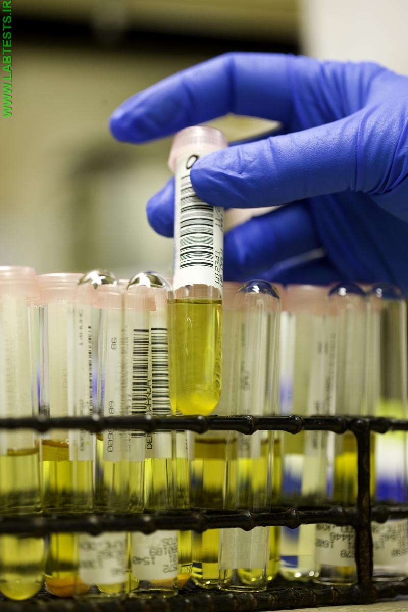 Urine samples for testing