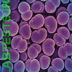 Photo of gonorrhea bacteria