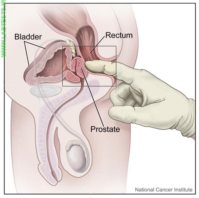 Drawing of a digital rectal exam