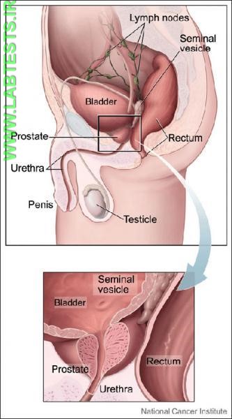 Image of Prostate