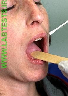 Photo of swabbing the throat