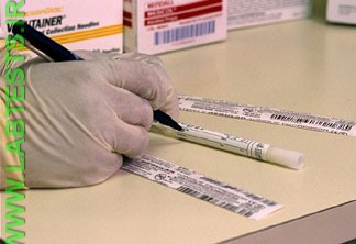 Labeling the sample