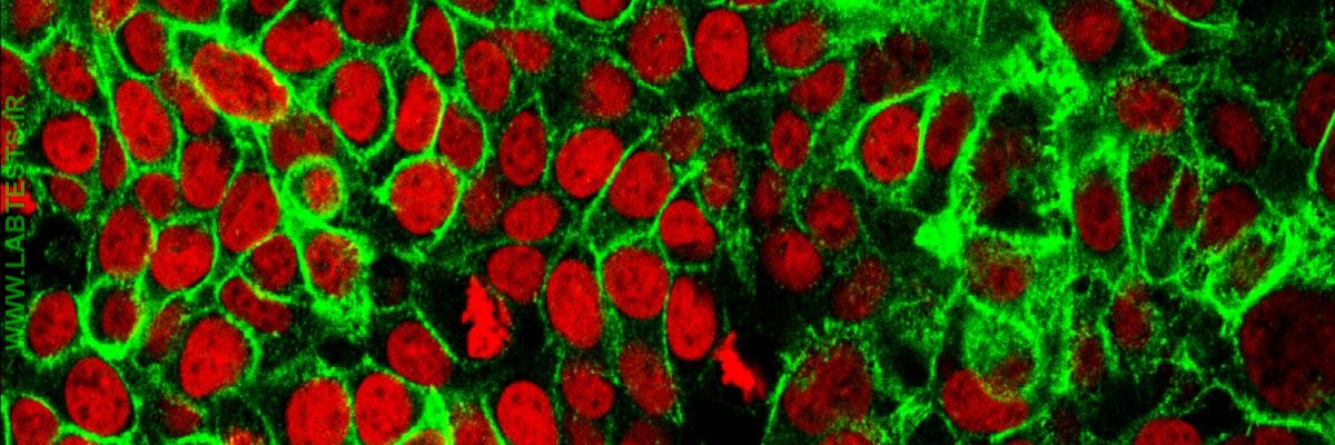 Colon cancer cells