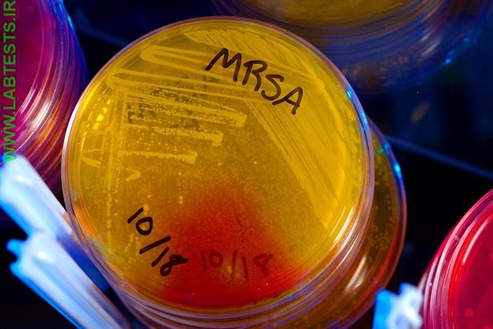 Photo of MRSA culture