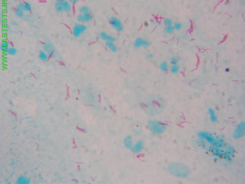 Photo of acid fast bacteria