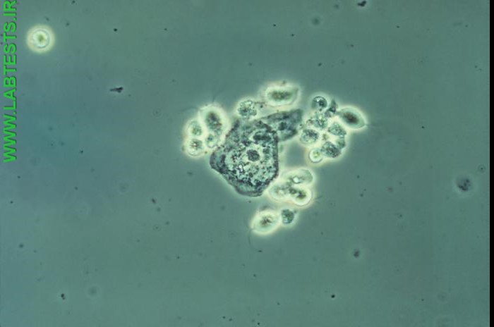 Image of T. vaginalis as seen under a microscope